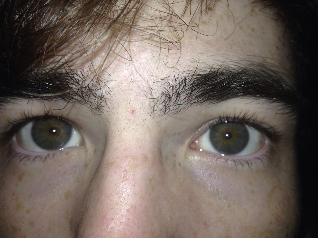 Muscarinic Antagonists Pharmacology Medbullets Step 1